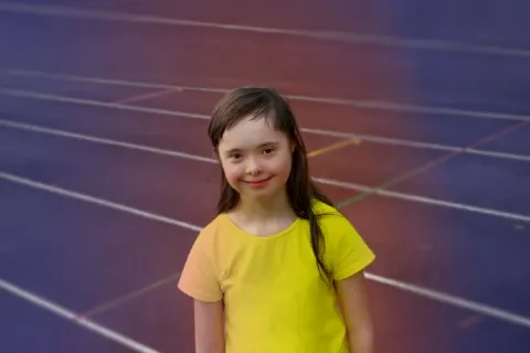 sindrome-de-down.webp